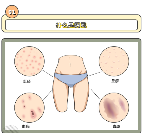 滄州男科檢查_私處癢癢癢，可能是這個(gè)小蟲子在作怪！(圖1)